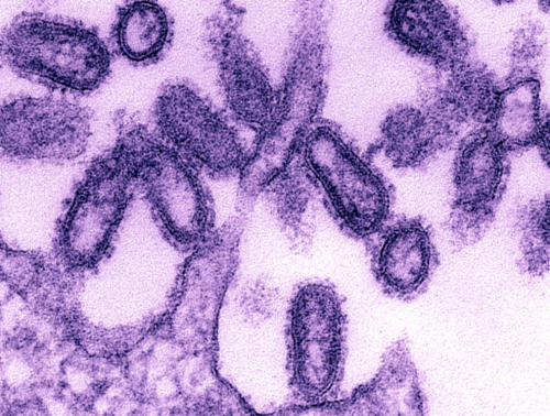 The Spanish Flu Epidemic